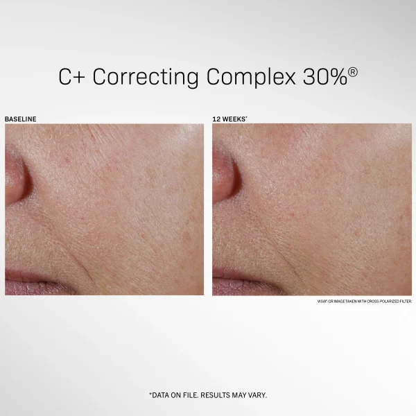 C Plus Correcting Complex revision skincare australia before and after images