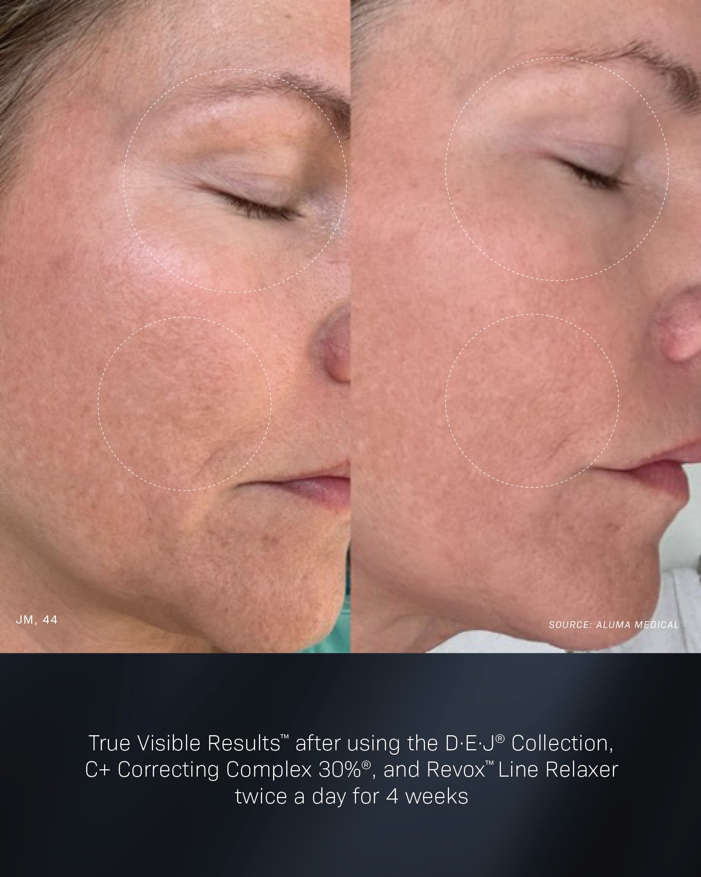 Revox™ Line Relaxer - Image 3