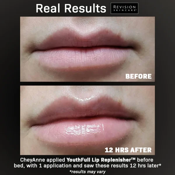 YouthFull Lip Replenisher before and after images