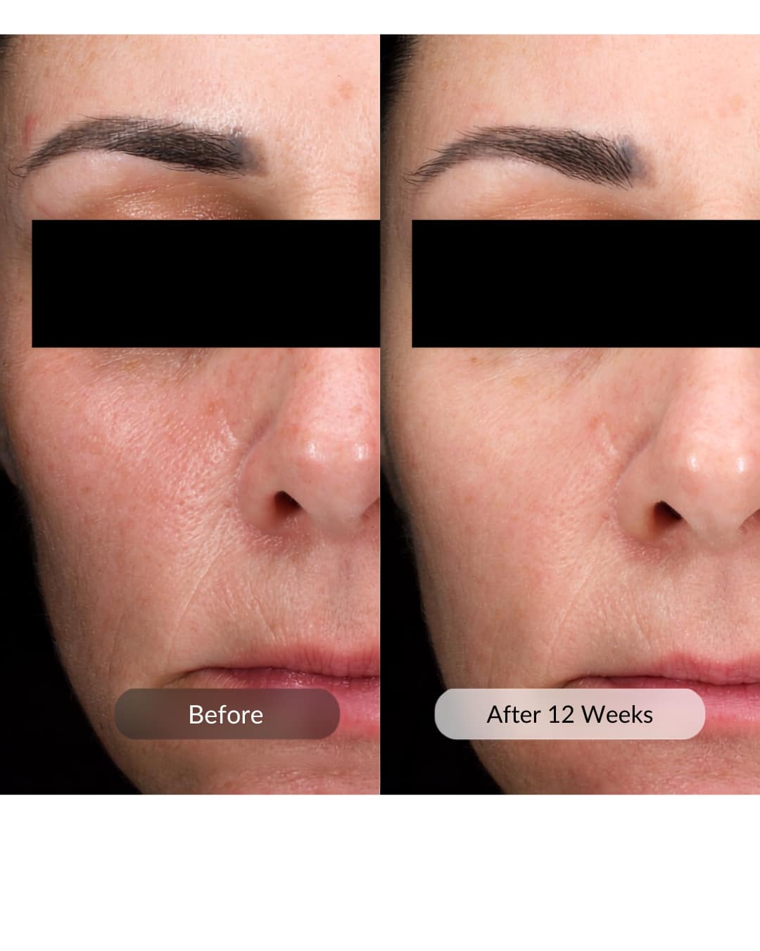 DEJ Daily Boosting Serum - Image 4