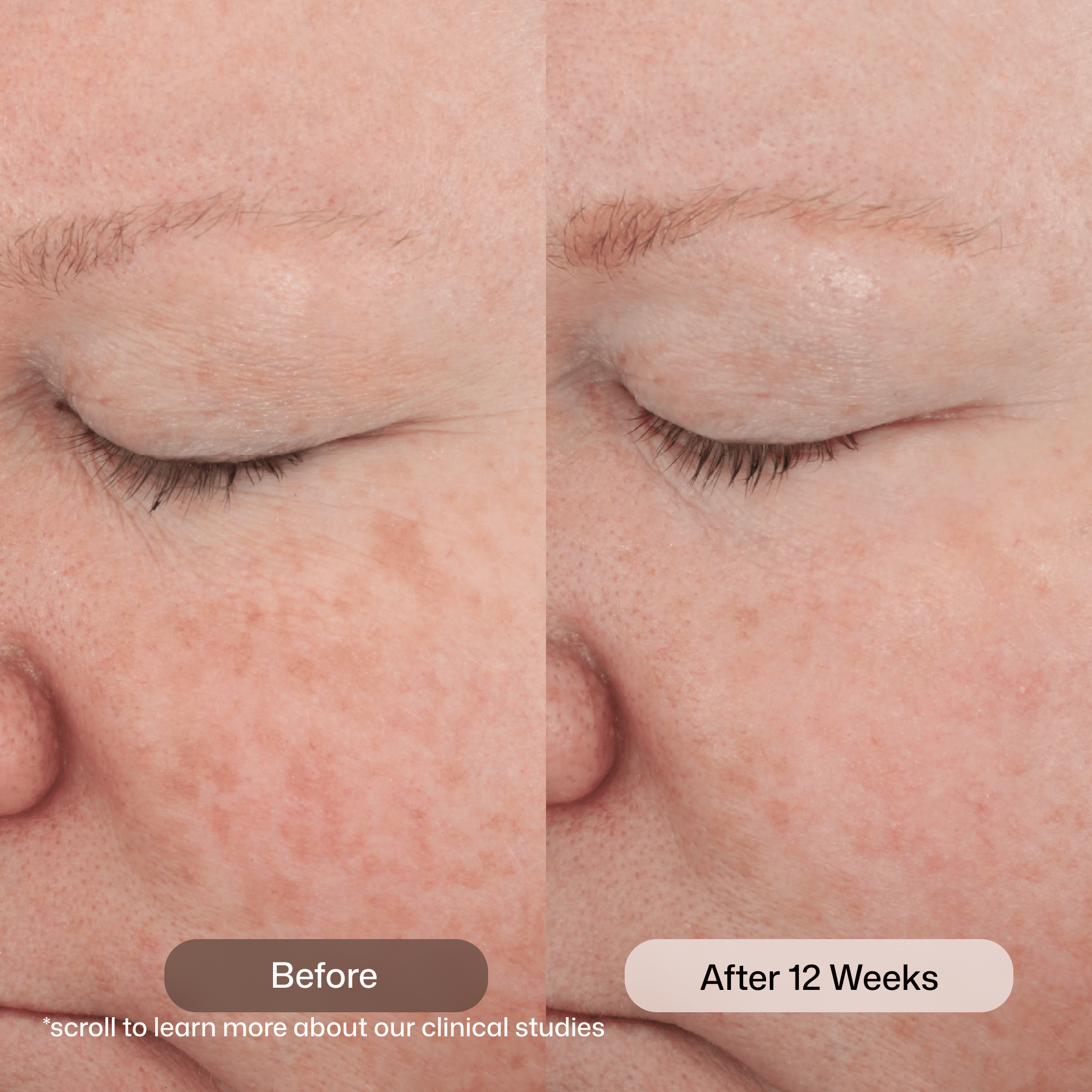 Retinol Complete 0.5 - Image 4